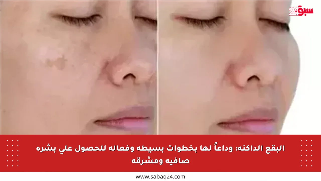 البقع الداكنة: وداعاً لها بخطوات بسيطة وفعالة للحصول على بشرة صافية ومشرقة